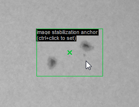 Selecting a surface feature for image tracking